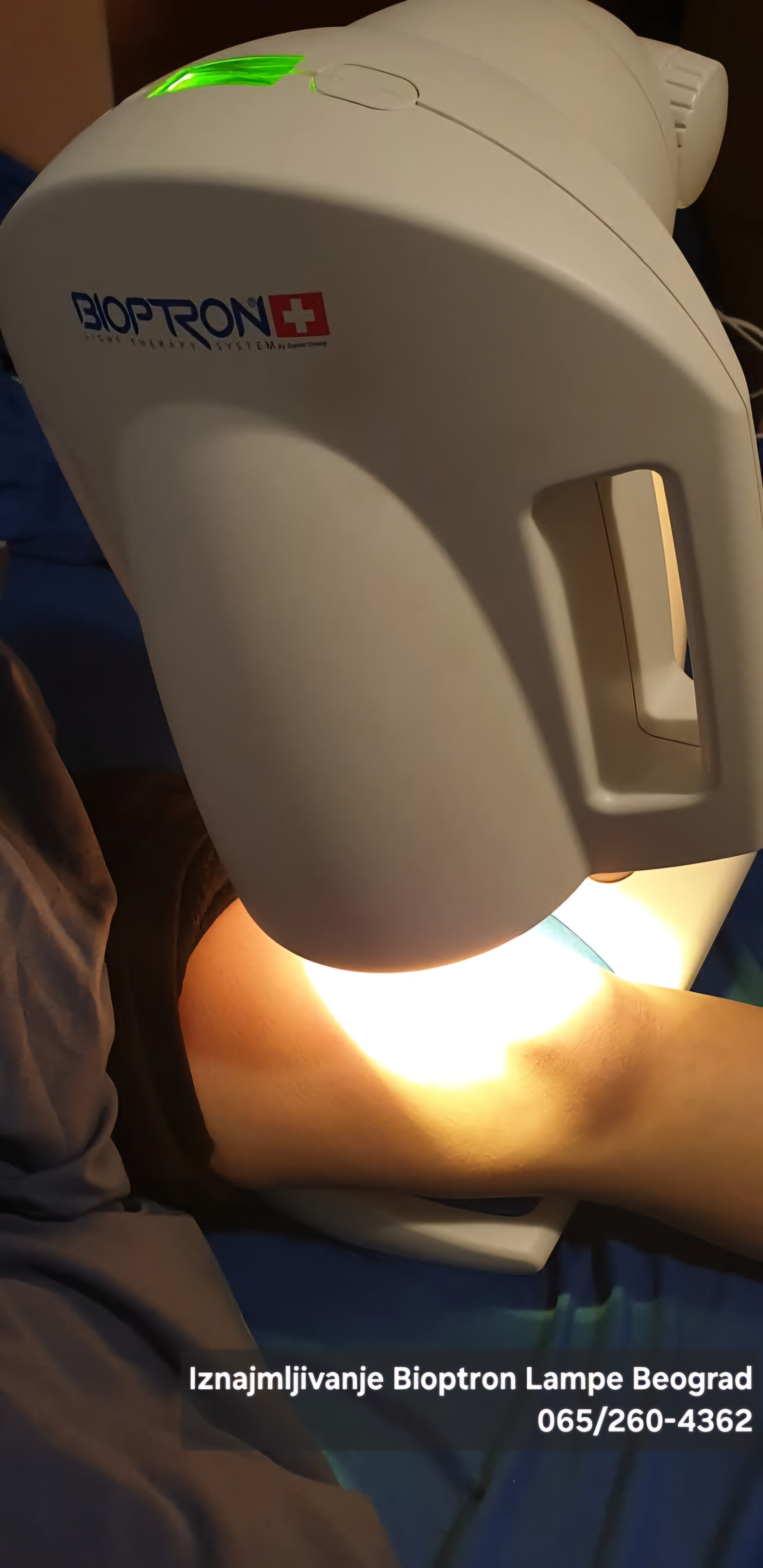 Koriscenje bioptron lampe kod povrede ligamenata skocnog zgloba tetiva rana na peti rana na nozi rana od dijabetesa dijabetes dekubit rane