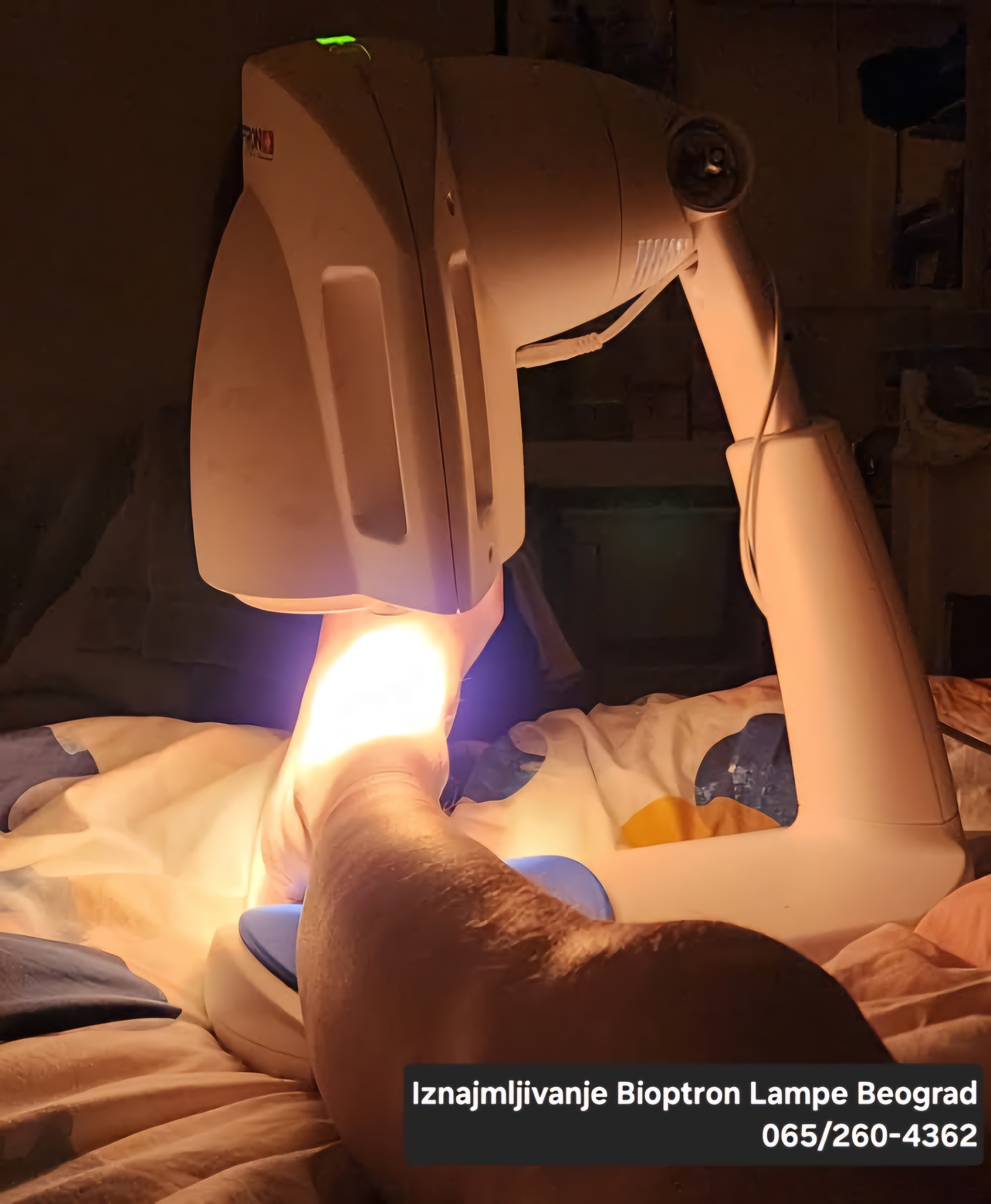 Bioptron Beograd svetlosna terapija lampa za lecenje rana i problema sa kozom problem