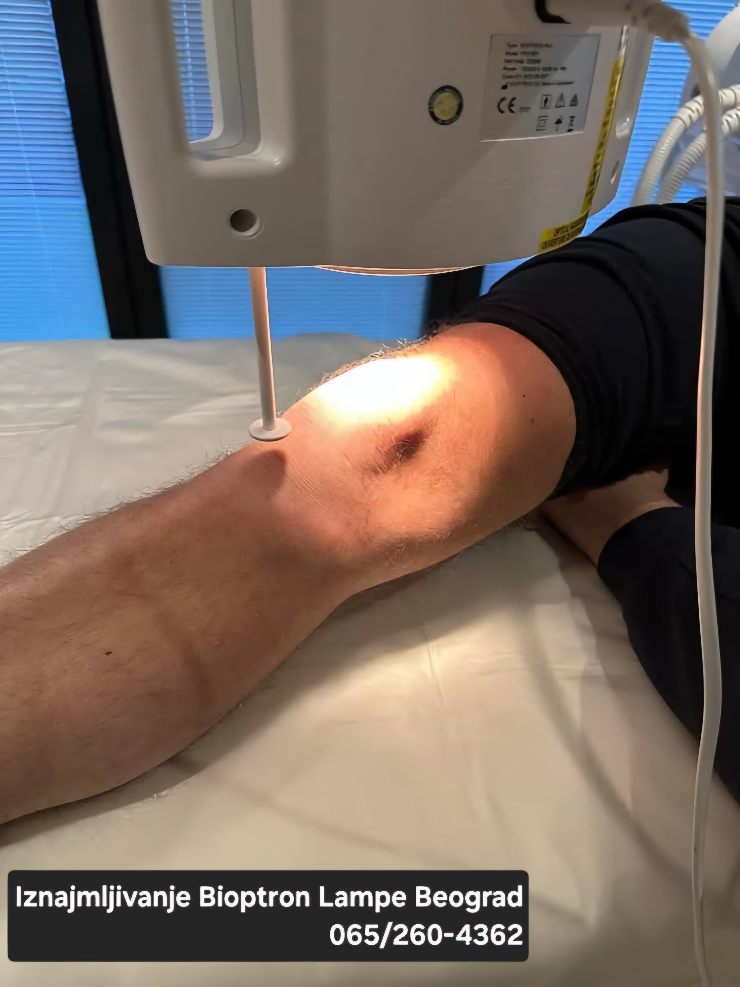 bioptron lampa bioptron lampa cena bioptron lampa iskustva bioptron medall bioptron light therapy bioptron light therapy price bioptron zepter bioptron lampa kupujemprodajem