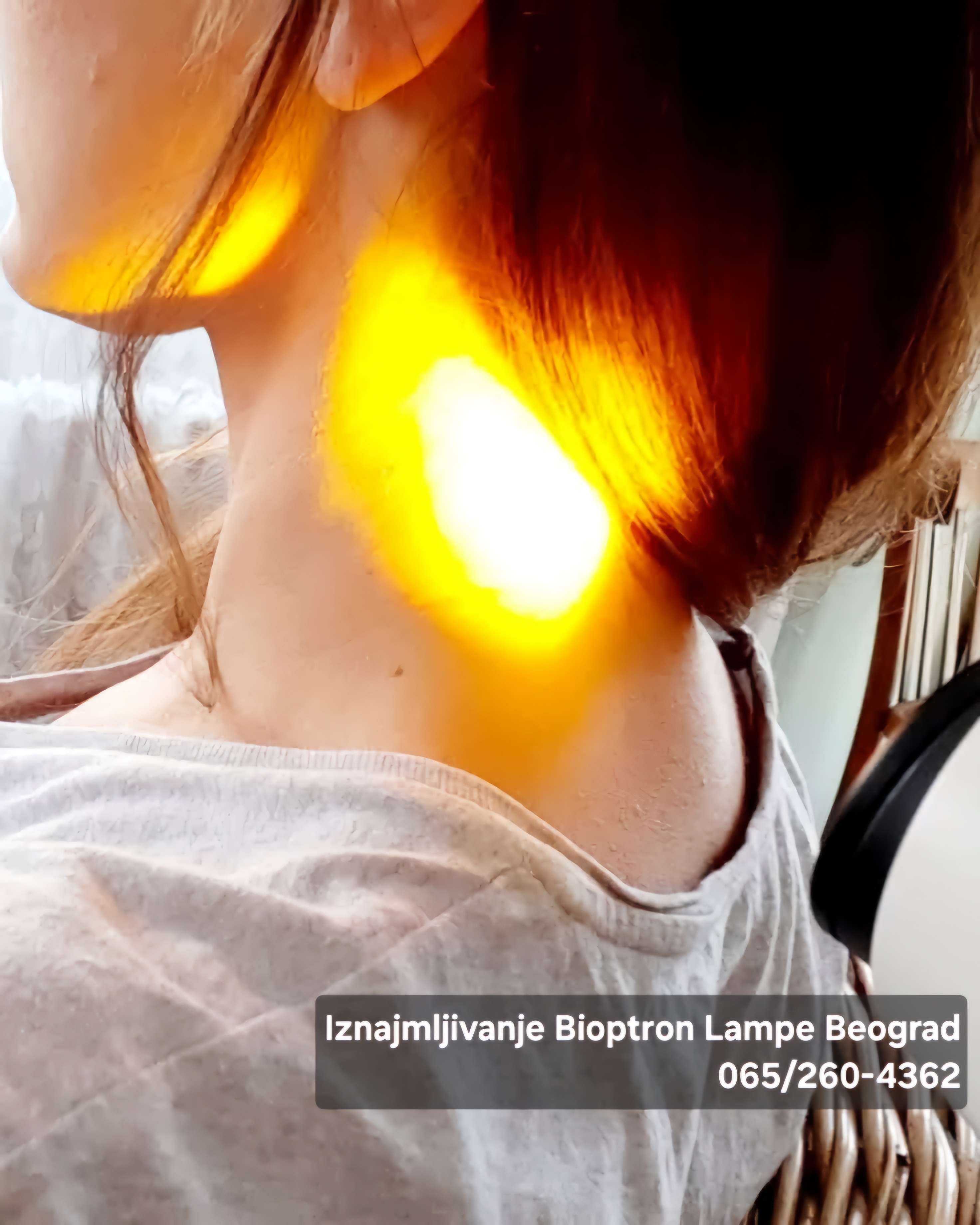 bioptron lampa za lečenje bioptron lampa za dermatologiju bioptron svetla terapija lampa bioptron svjetiljka bioptron svetle terapije bioptron lampa bioptron svetlosna lampa